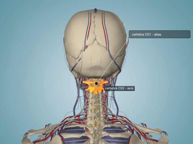 Atlas axis spine syndrome